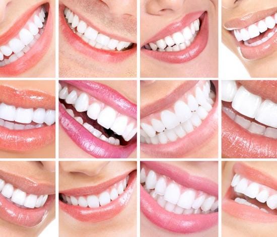 Smile Design in Antalya Turkey