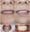 All on 6 and Zirconium Crowns