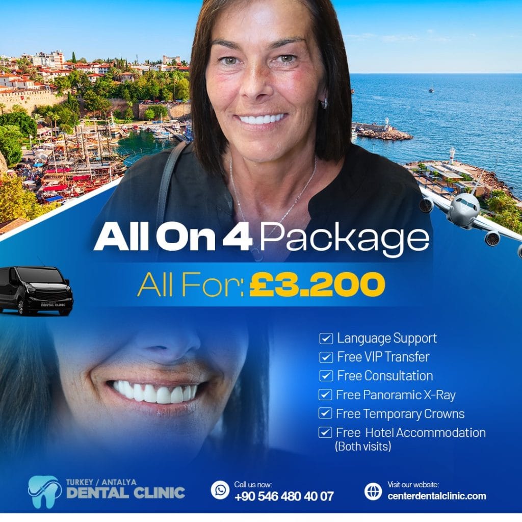 All on 4 Dental Implant in Antalya