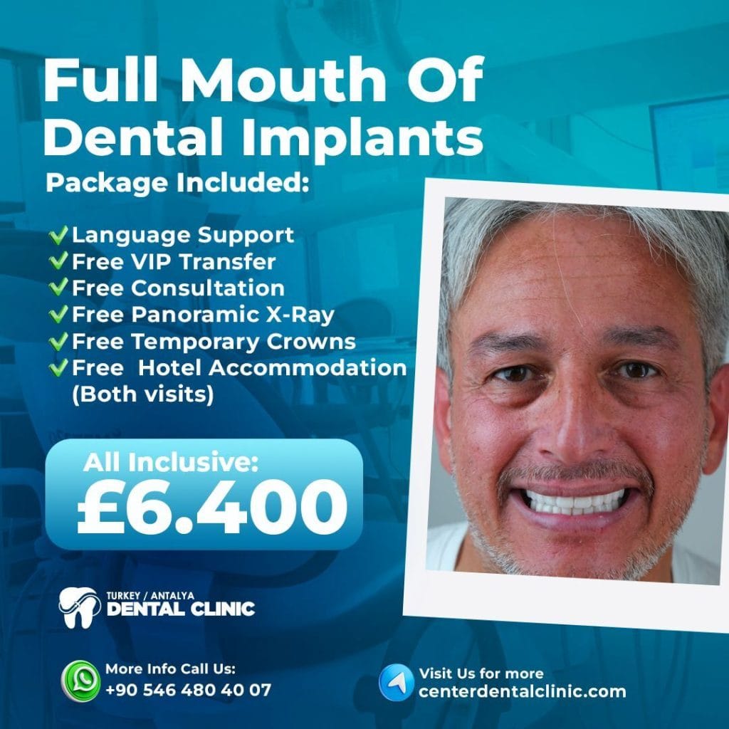 Zirconia Dental Implants Turkey 17 Full Mouth Dental Implant in antalya Turkey