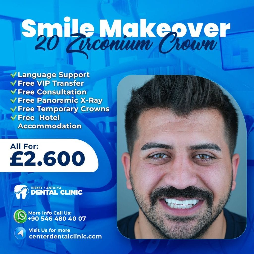 Smile Design in Antalya Turkey 16 Smile Makeover