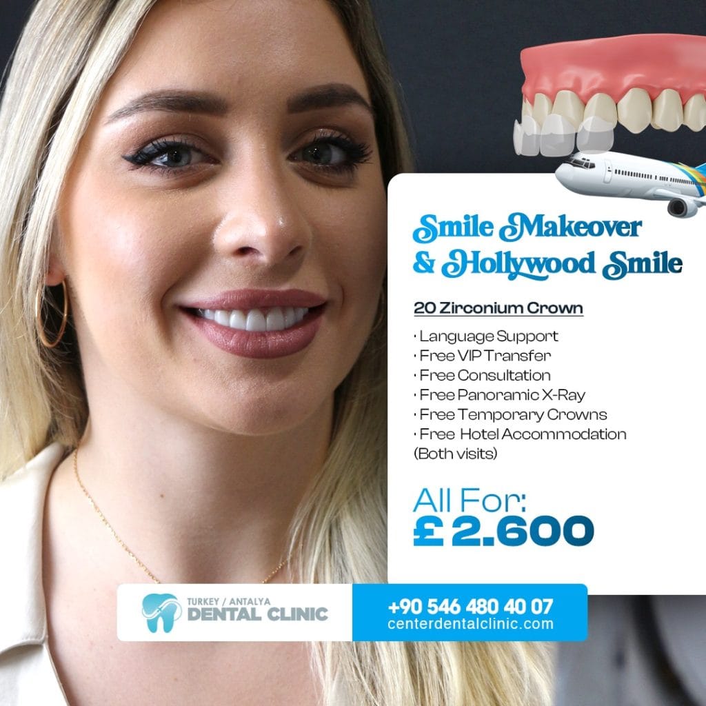 Smile Design in Antalya Turkey 15 Smile Design in Antalya Turkey