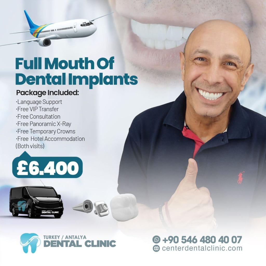 Zirconia Dental Implants Turkey 16 implant-in-antalya-turkey (1)