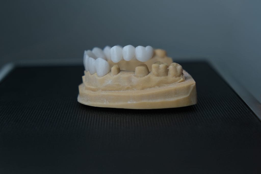 Dental Crowns in Antalya 15 Dental Crowns in Antalya Turkey