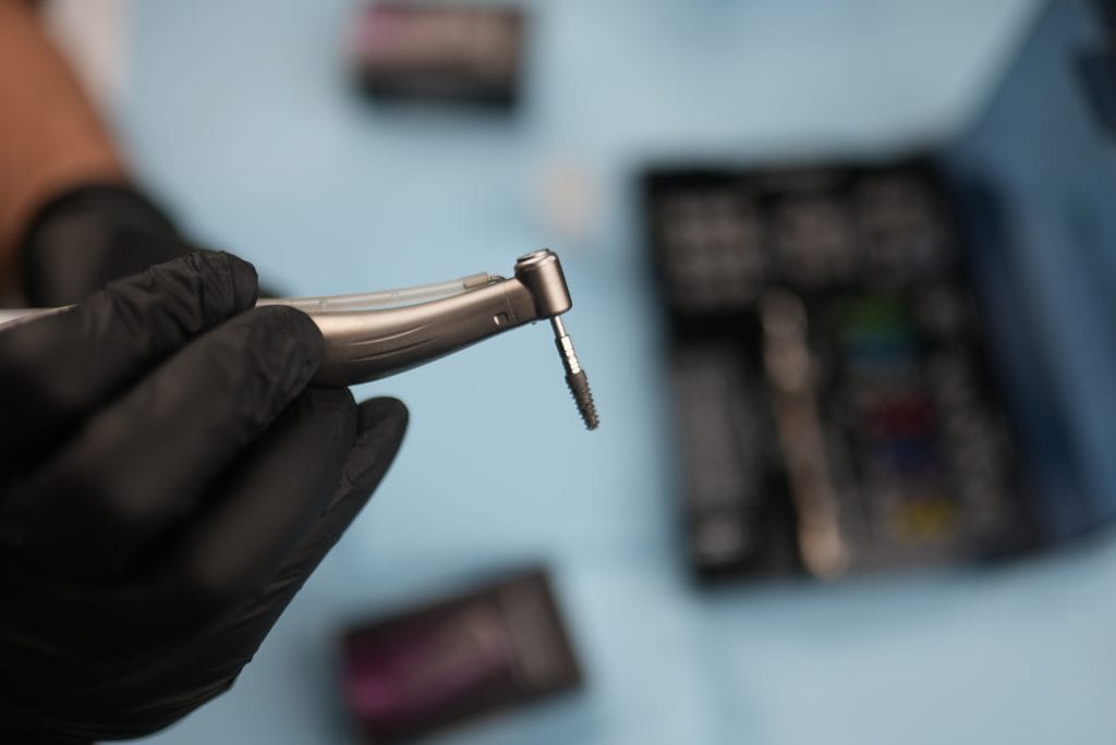 Dental Implants in Antalya Turkey 15 Dental Implants Antalya Turkey