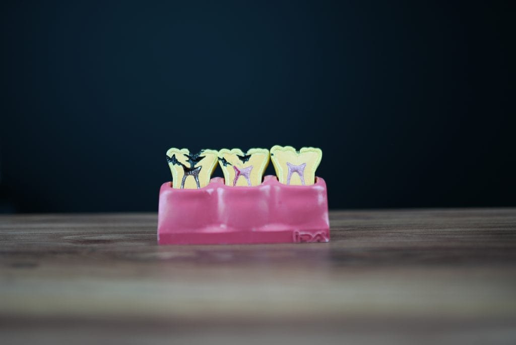 Dental Root Canal Treatment in Antalya 15 Dental Root Canal Treatment in Antalya Turkey