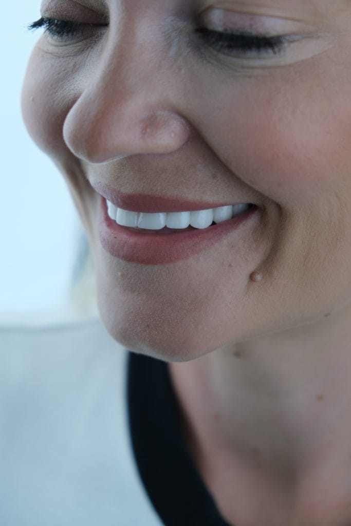 Aesthetic Dentistry Antalya Turkey 1 laminate veneer turkey | Aesthetic Dentistry Antalya Turkey