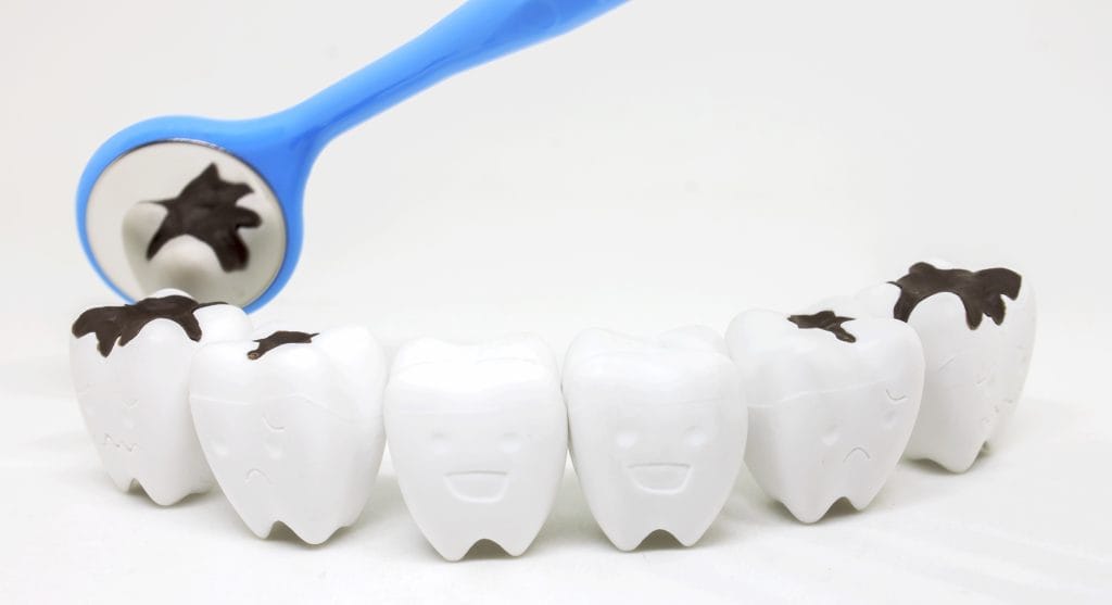 dental filling in Antalya Turkey