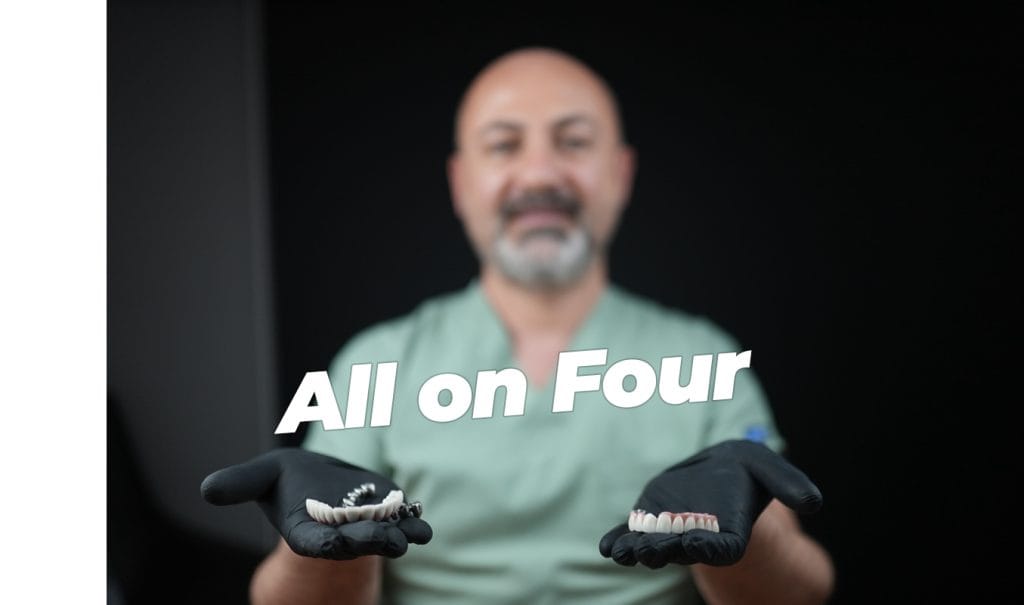 All on 4 Implants Antalya Turkey