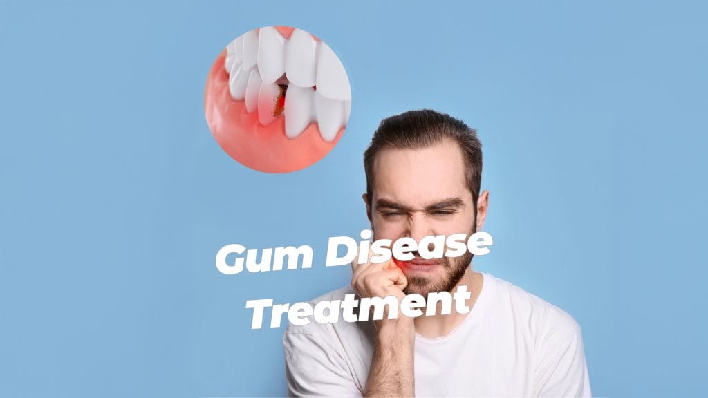 Gum Disease Treatment dental clinic - Antalya Turkey
