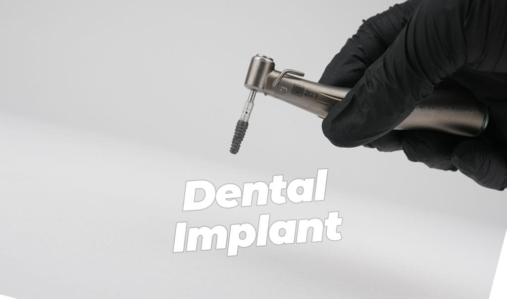 Dental Implant in Antalya Turkey