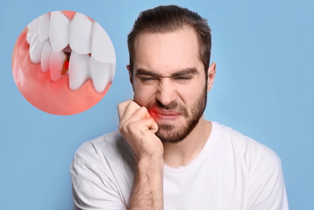 Gum Disease Treatment dental clinic - Antalya Turkey