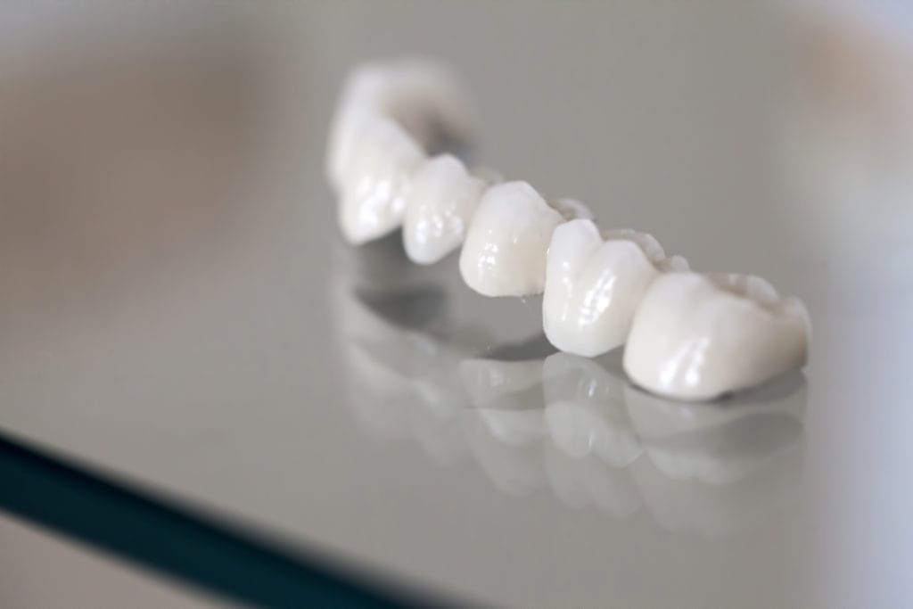 Porcelain Crowns in Antalya Turkey 1 Porcelain Crowns in Antalya Turkey