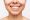 Teeth Whitening Turkey