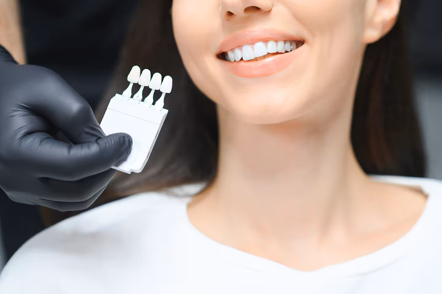 Best Teeth Whitening Methods