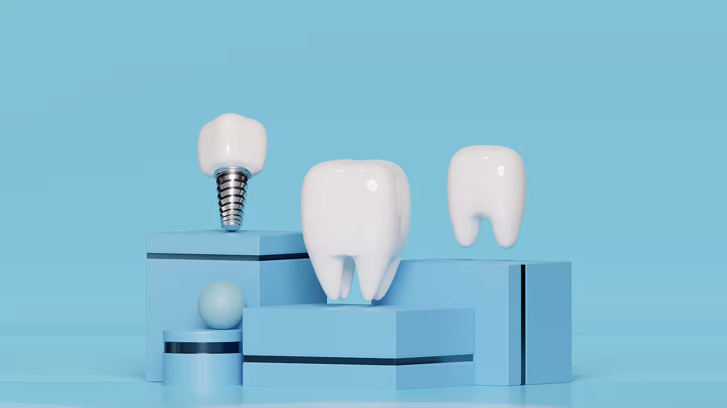 All on Six Antalya treatment planning at Center Dental Clinic with digital implant consultation
